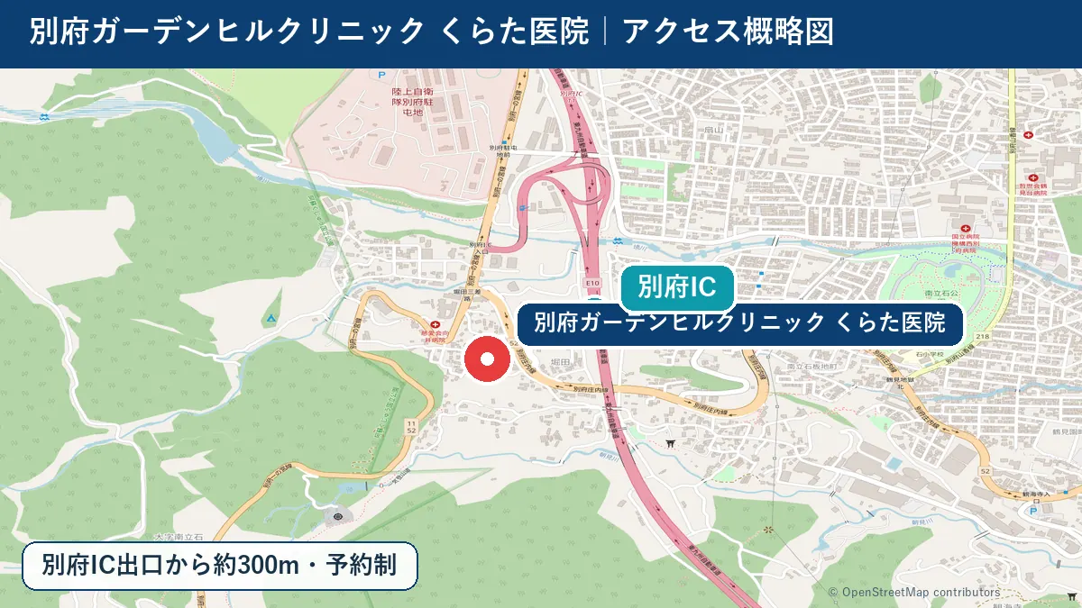 くらた医院と別府ICの位置を示すアクセス概略図