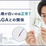抜け毛の毛根が白いのは正常？白い塊・AGAとの関係【2026年版】