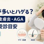 フケ・脂漏性皮膚炎とAGA・抜け毛の違い