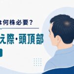 自毛植毛の必要株数とM字・生え際・頭頂部の目安